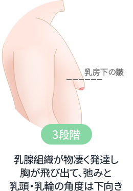 乳腺組織が物凄く発達し胸が飛び出て、弛みと乳頭・乳輪の角度は下向き