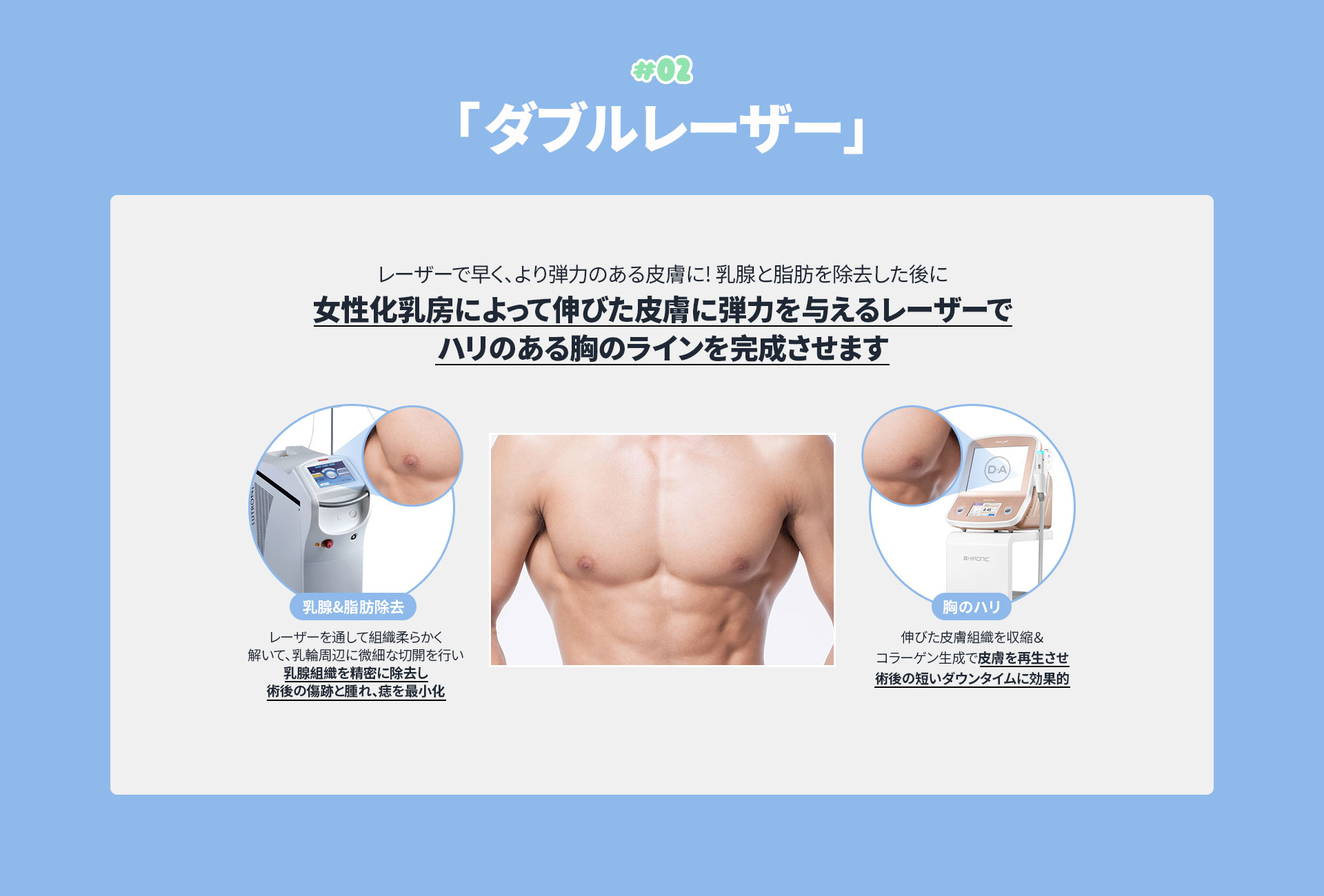 DA 女性化乳房
