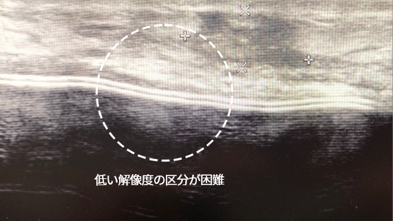 低い解像度の区分が困難 