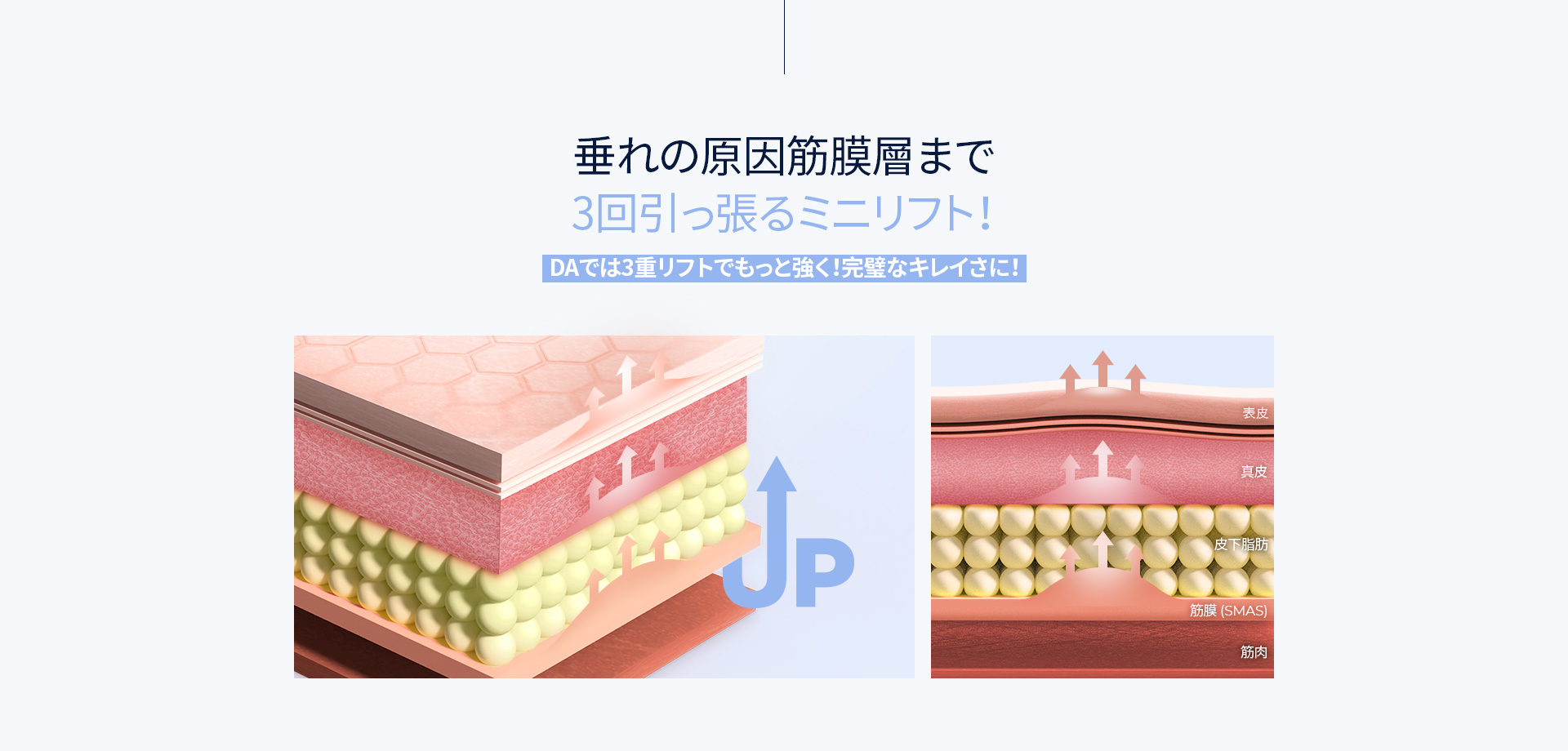 垂れの原因筋膜層まで3回引っ張るミニリフト！