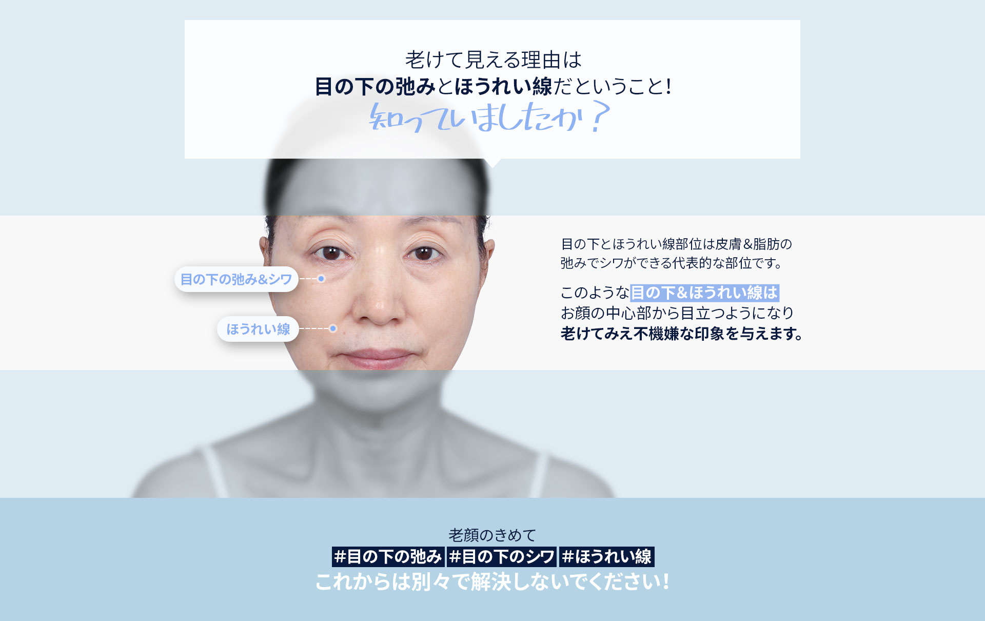 DA中顔面リフト