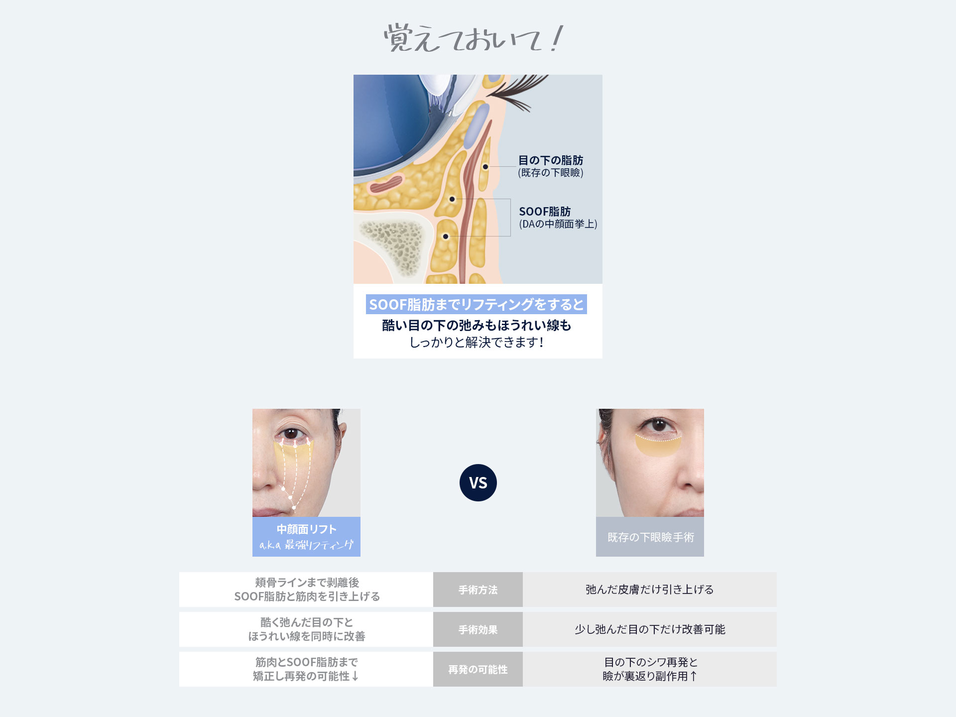 DA中顔面リフト