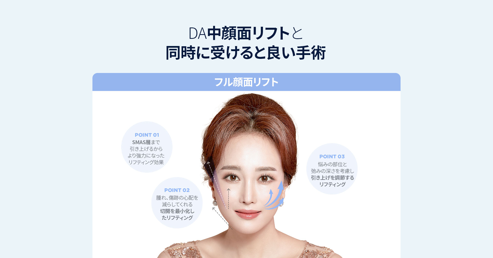 DA中顔面リフト