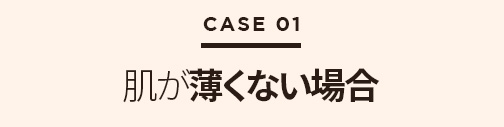 鼻再手術ソリューション 