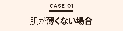 鼻再手術ソリューション