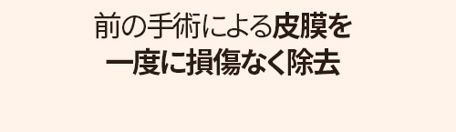 鼻再手術ソリューション 