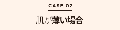 鼻再手術ソリューション