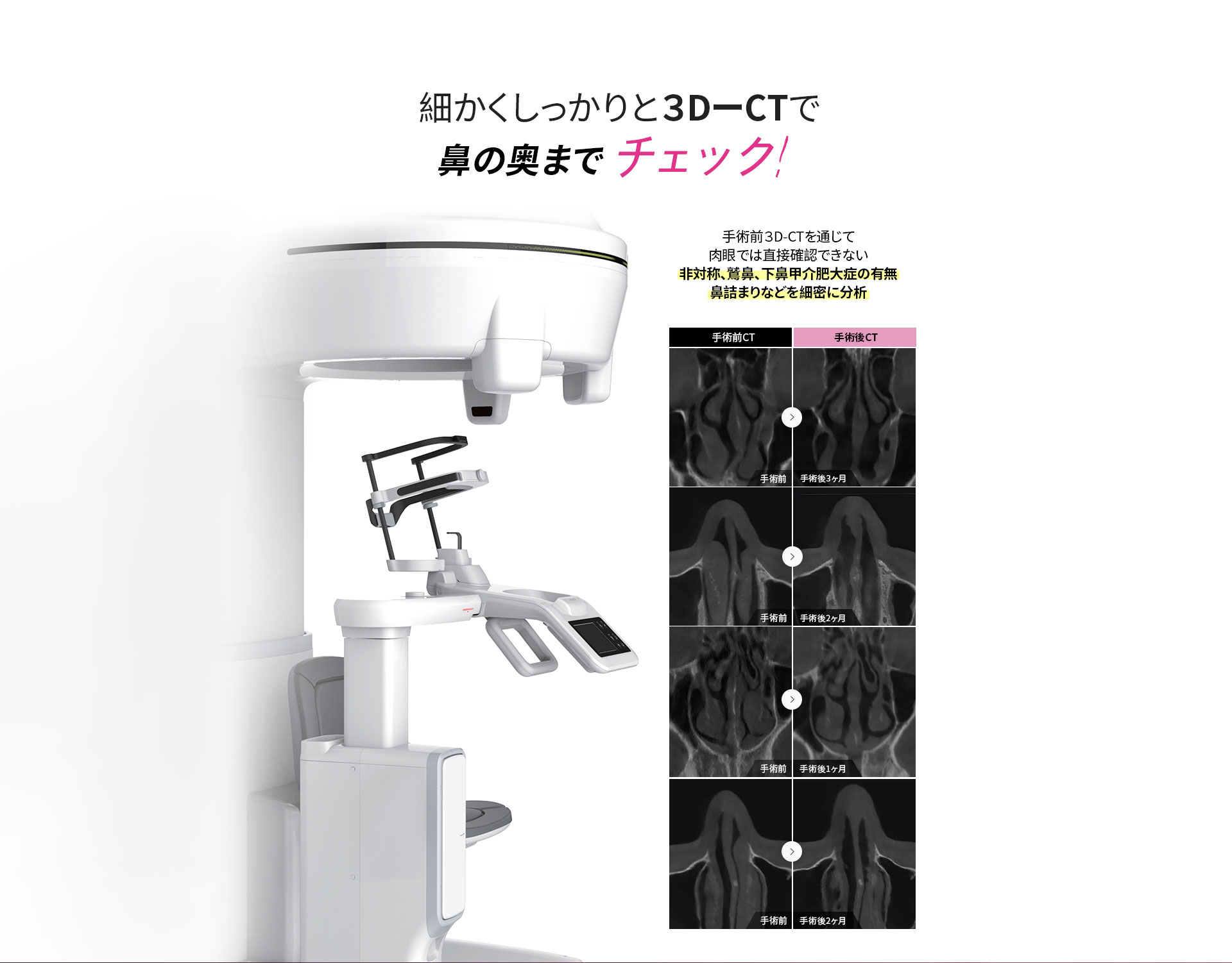 細かくしっかりと３DーCTで鼻の奥までチェック！