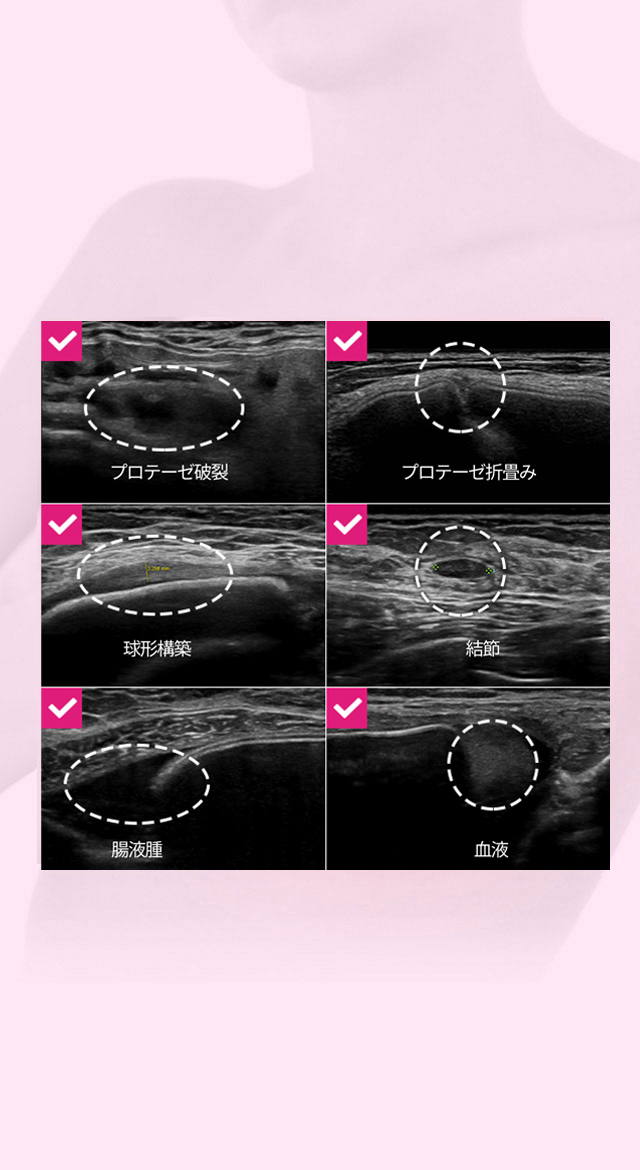 DA 症状がなく、より不安なプロテーゼ問題