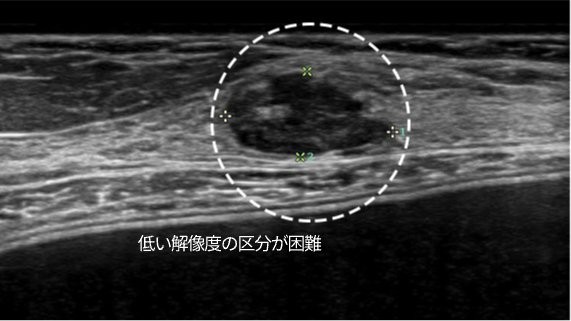 低い解像度の区分が困難 