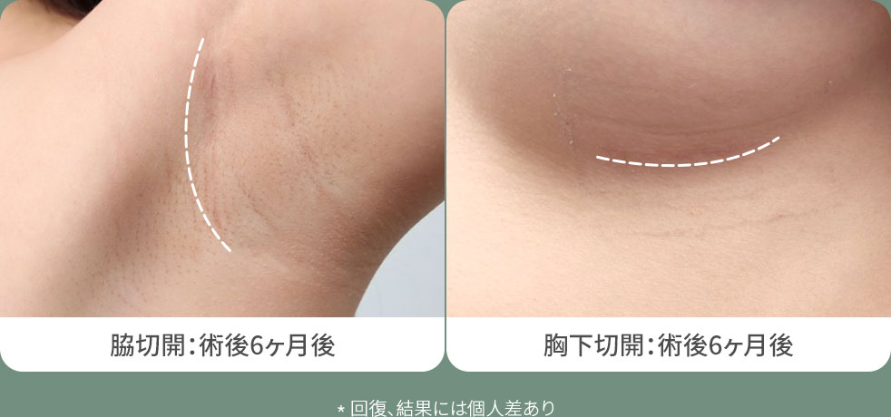 DA豊胸整形