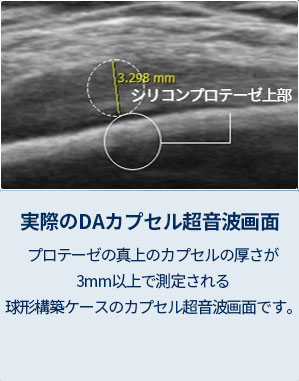 DA実際のDAカプセル超音波画面