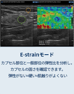 DAE-strainモード