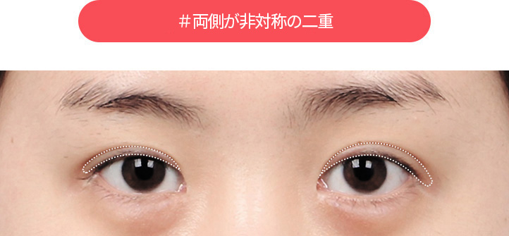 DA#両側に非対称(凹凸)のツイン袖口 