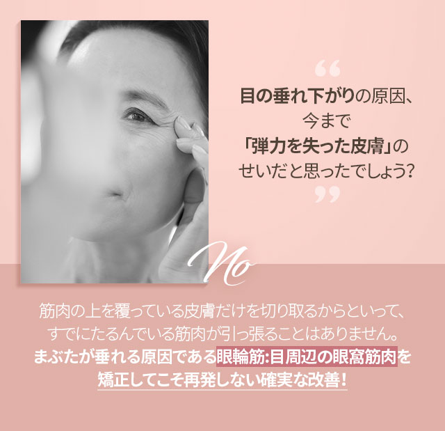 大ヒット上眼瞼