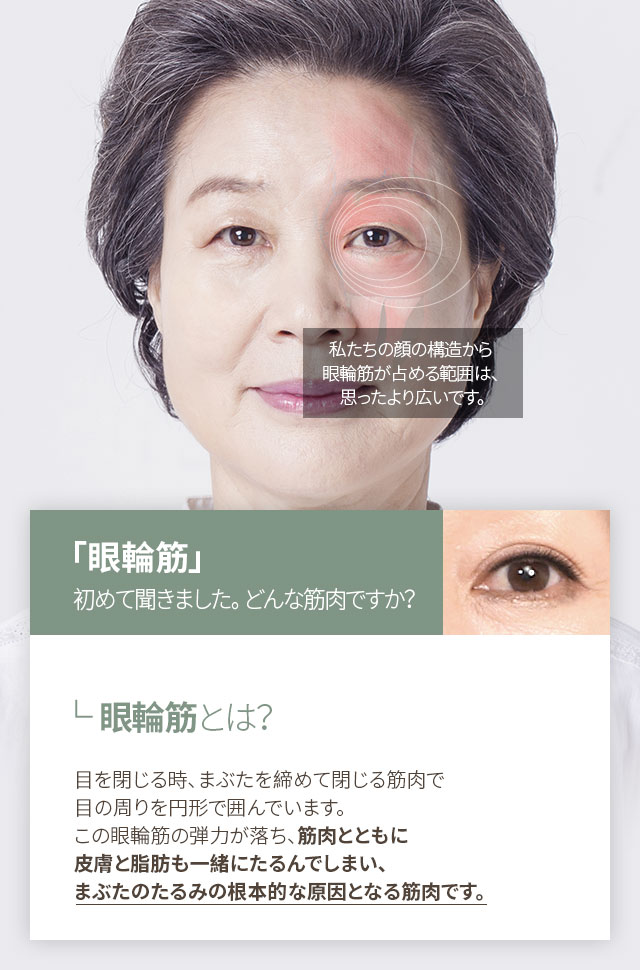 大ヒット上眼瞼