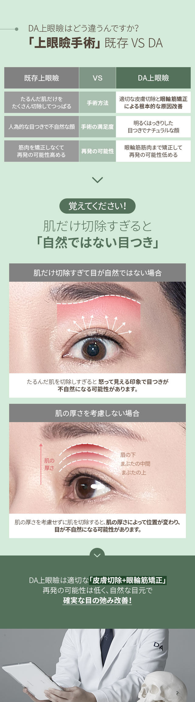 大ヒット上眼瞼