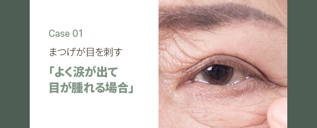 まつげが目を刺す 「よく涙が出て目が腫れる場合」
