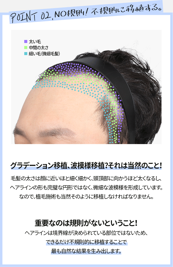 NO規則！不規則に移植する。