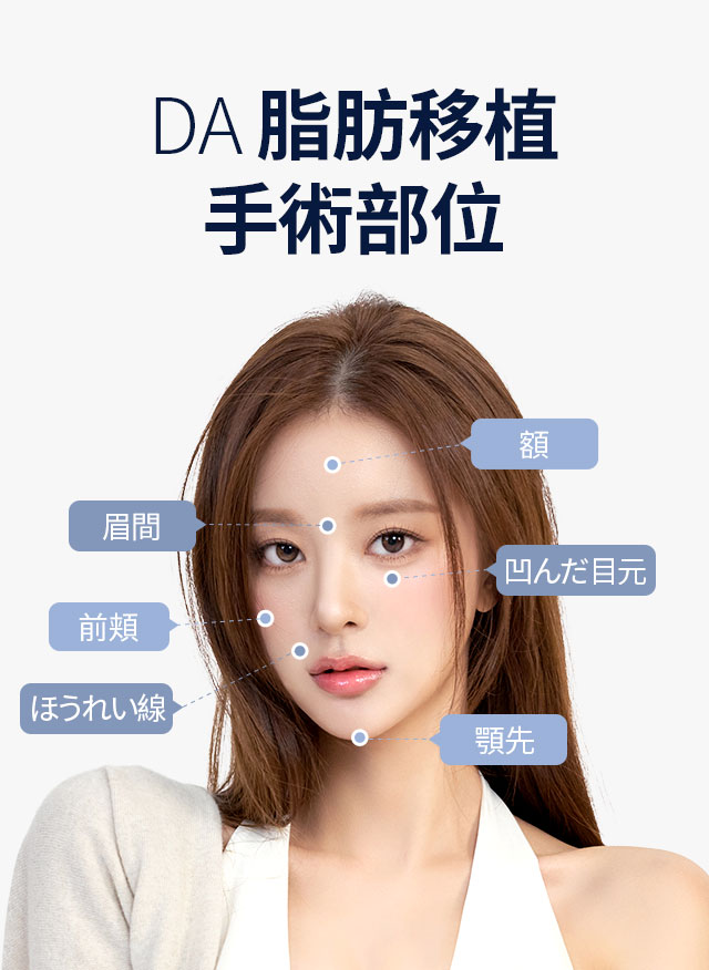 DA 脂肪移植 手術部位