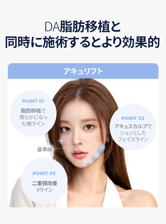 DA脂肪移植と同時に施術するとより効果的