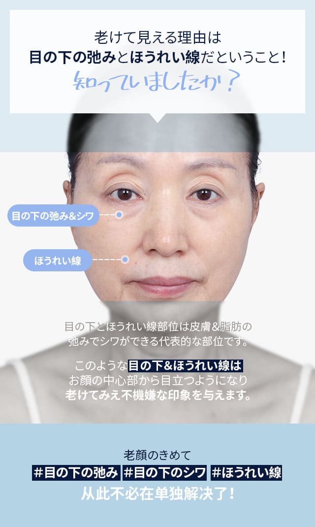 DA中顔面リフト