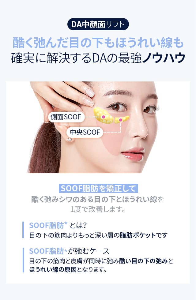 DA中顔面リフト