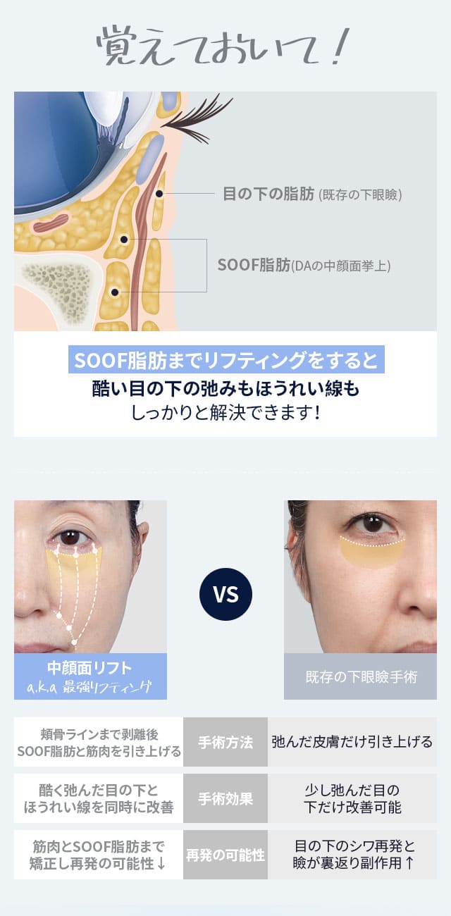 DA中顔面リフト