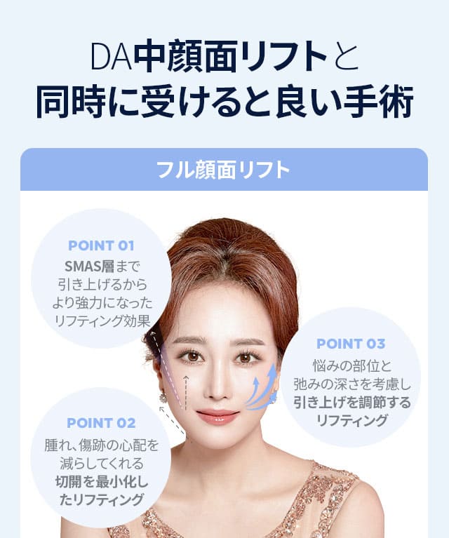 DA中顔面リフト