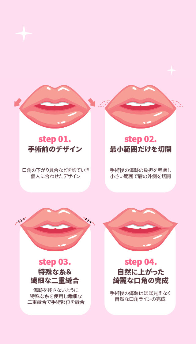 DA口角挙上手術
