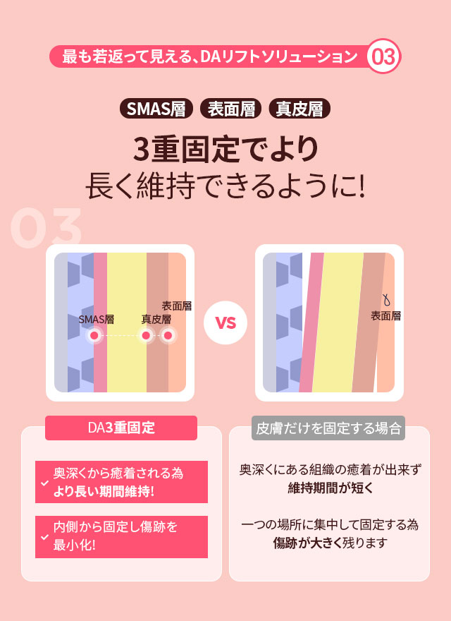 DA 垂直ミニリフト