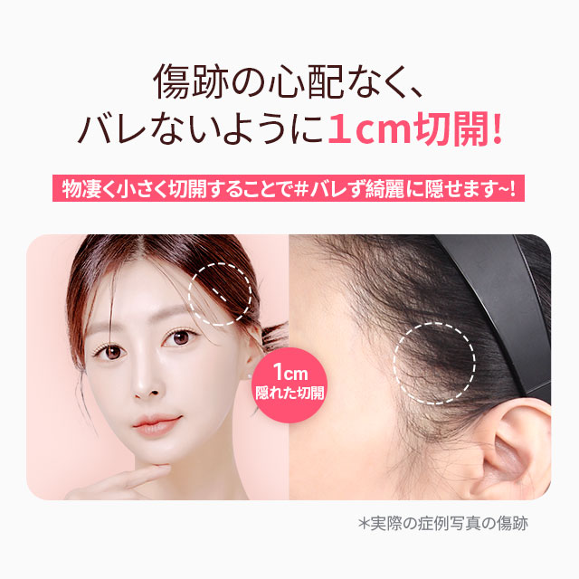 DA 垂直ミニリフト