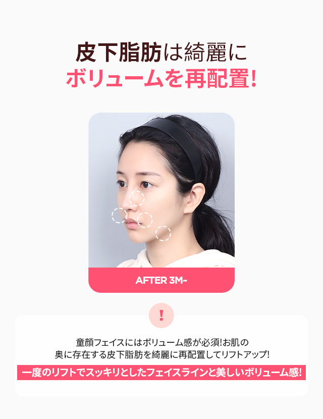 DA 垂直ミニリフト