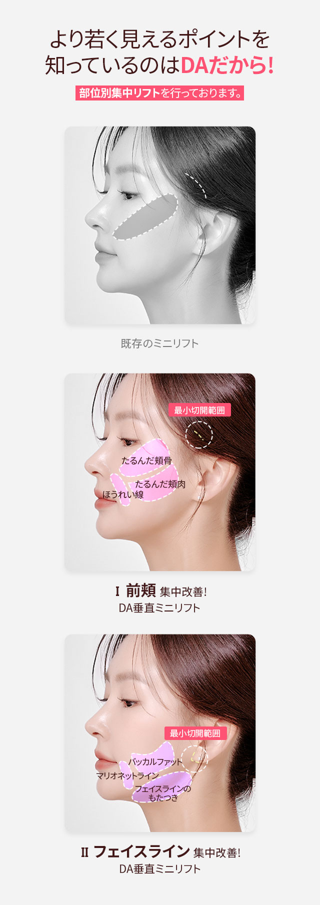 DA 垂直ミニリフト