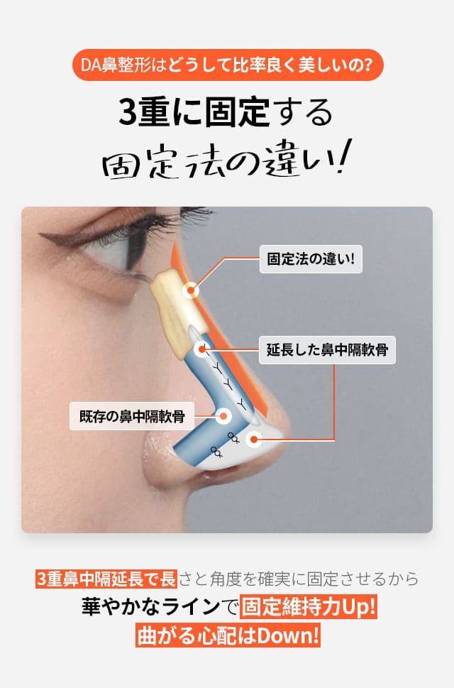 自家肋軟骨鼻整形