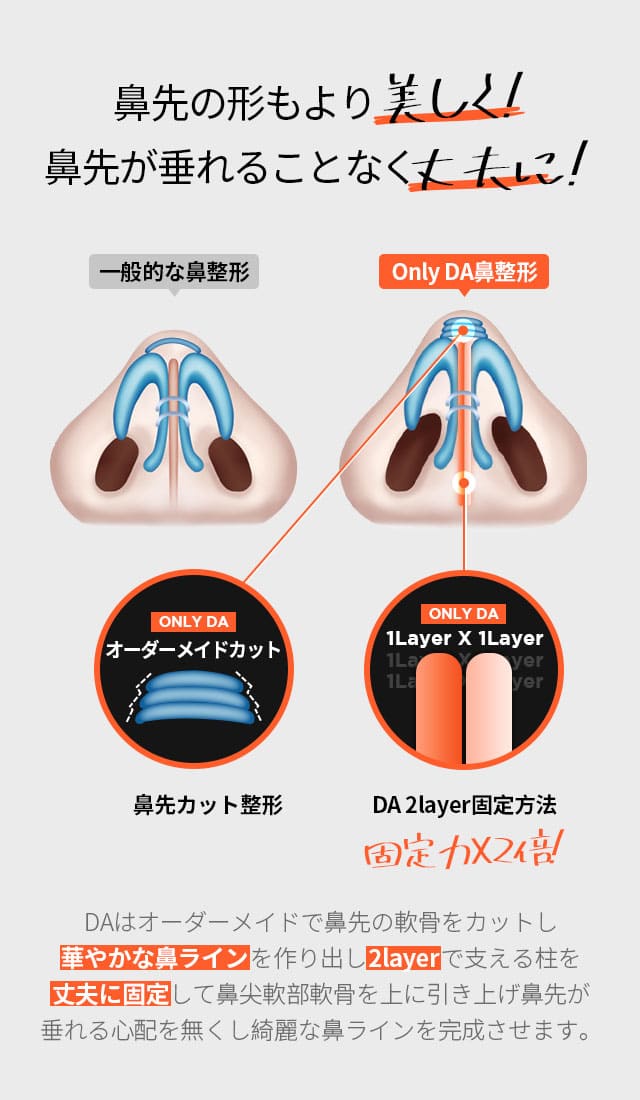 自家肋軟骨鼻整形