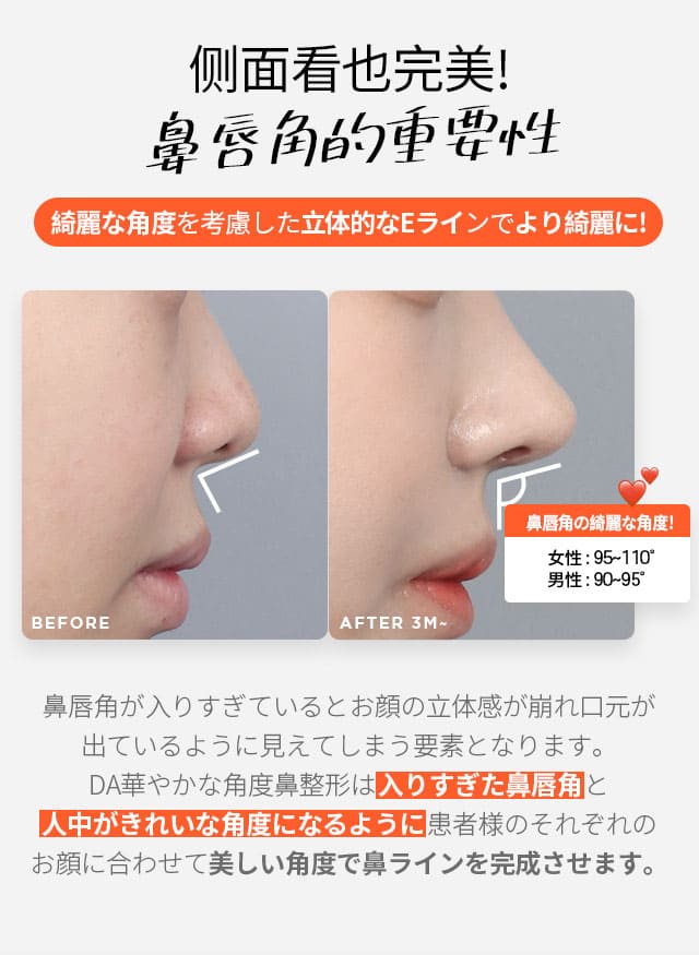 自家肋軟骨鼻整形