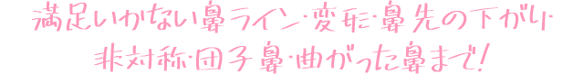 DA2度目の鼻整形