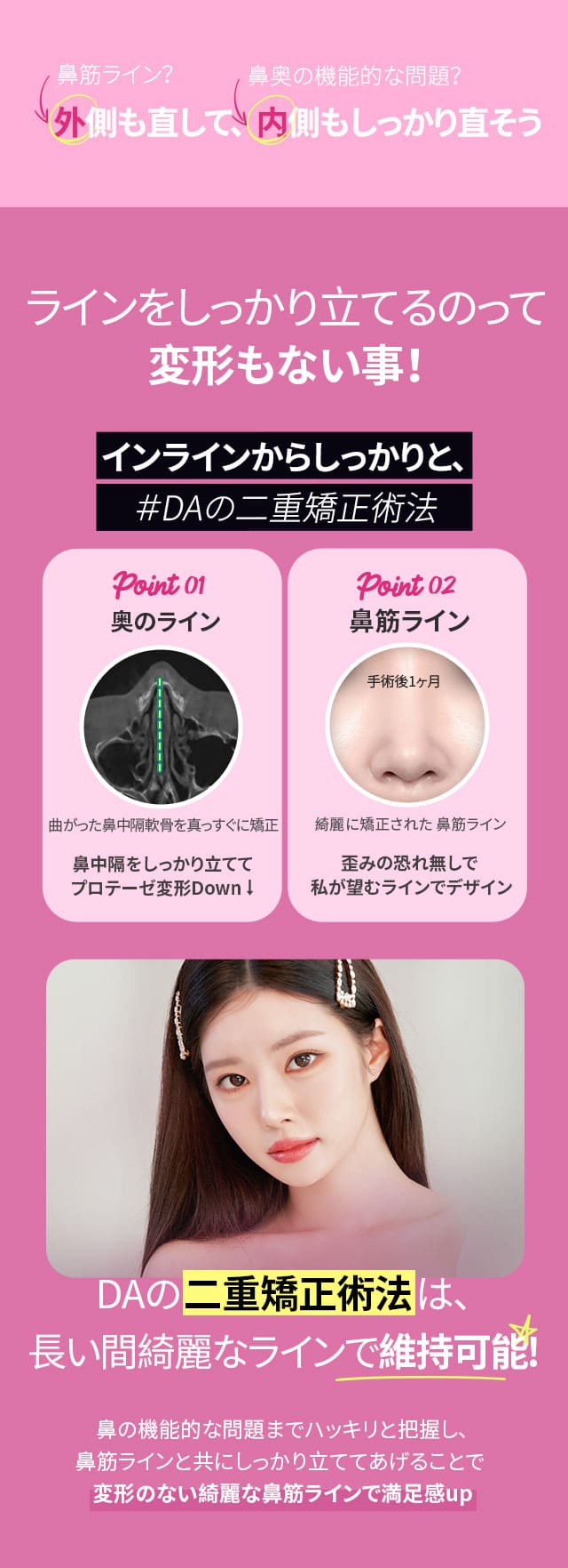 インラインからしっかりと、＃DAの二重矯正術法