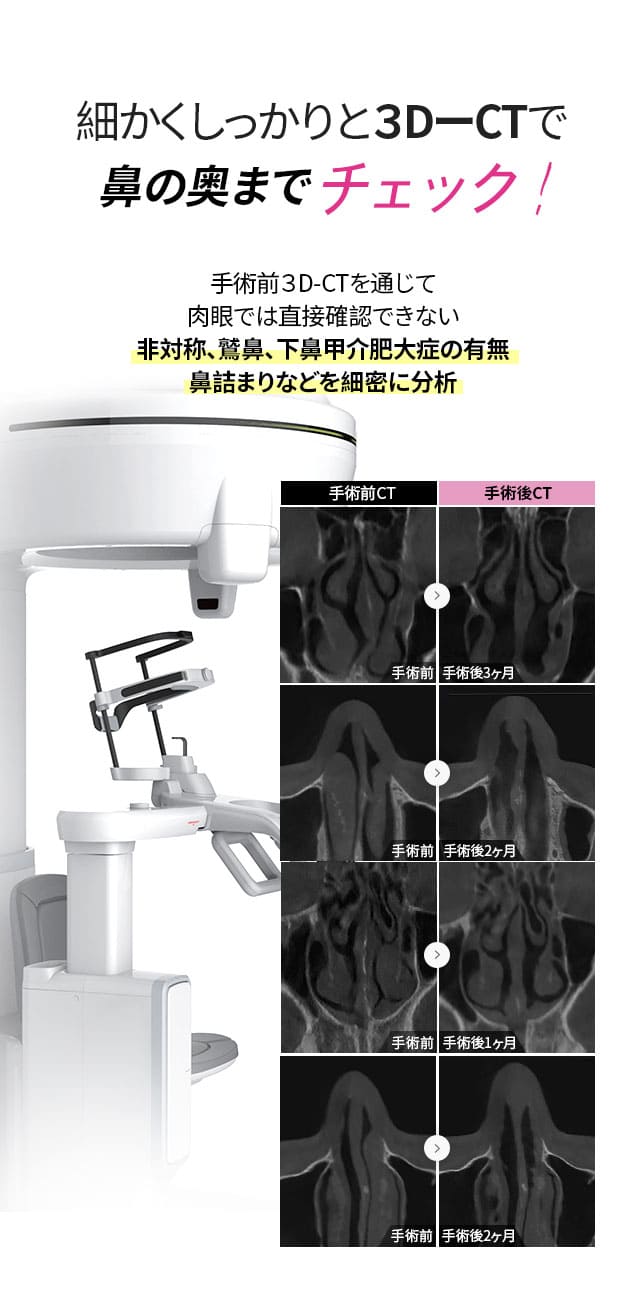 細かくしっかりと３DーCTで鼻の奥までチェック！