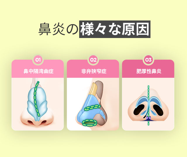 鼻炎の様々な原因