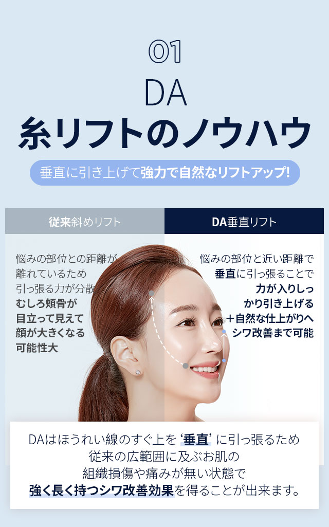 01.DA糸リフトのノウハウ