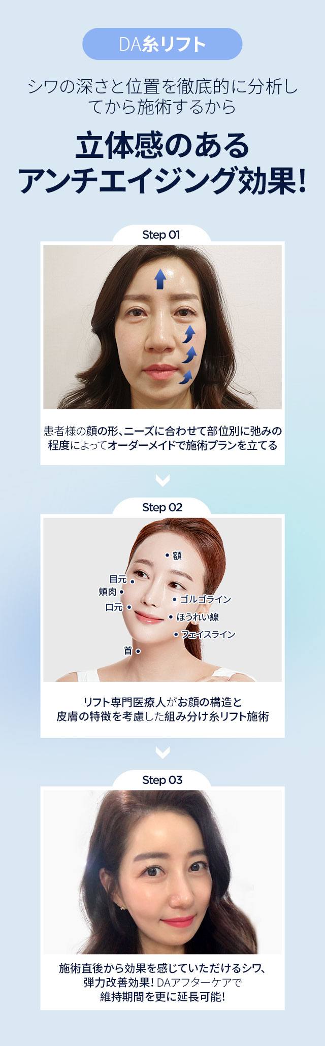 DA糸リフト!立体感のあるアンチエイジング効果!