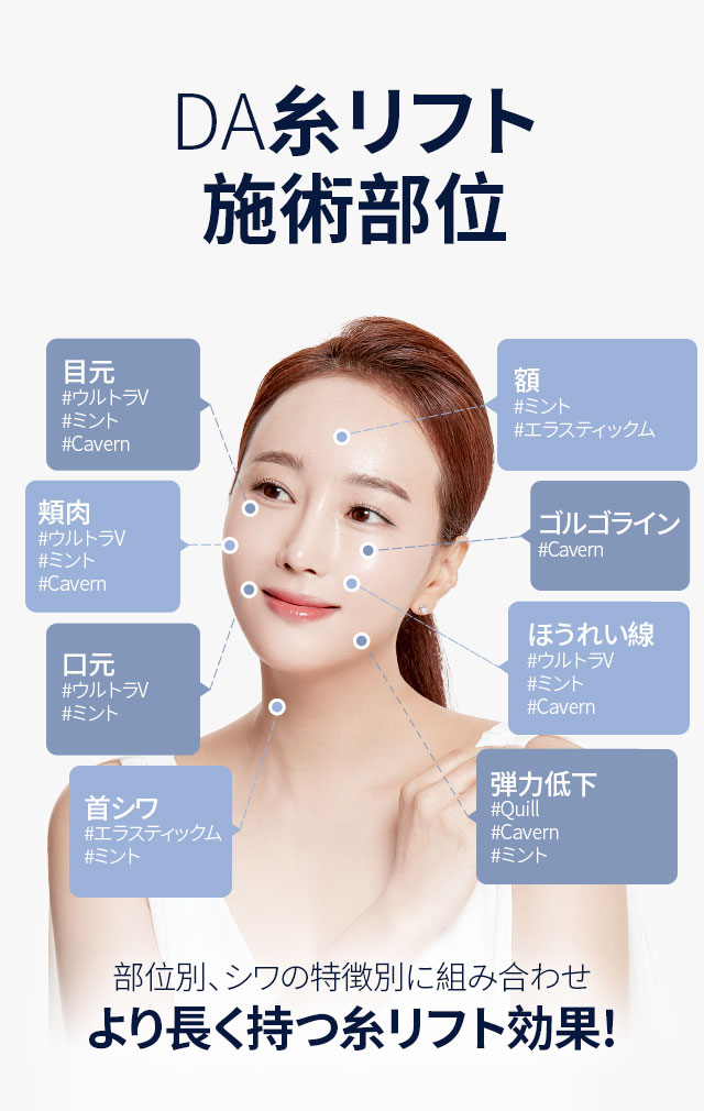 DA糸リフト施術部位